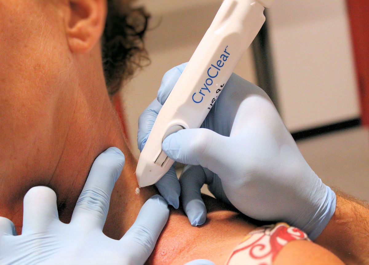Utbildning CryoClear (Kryopenna)